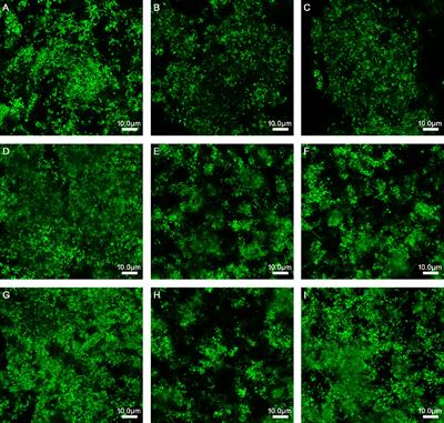 Lactobacillus rhamnosus and Lactobacillus casei Affect Various Stages of Gardnerella Species Biofilm Formation